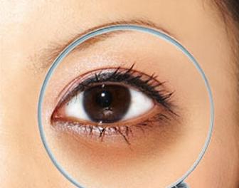 黑眼圈显憔悴教你5种方法来消除,黑眼圈很重气色很差怎么改善