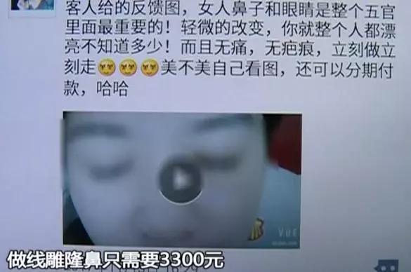 线雕隆鼻取出来要多少钱,线雕隆鼻8000