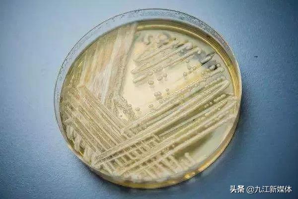 脚气肺部真菌感染的致死率,真菌感染到肺部致死率多少