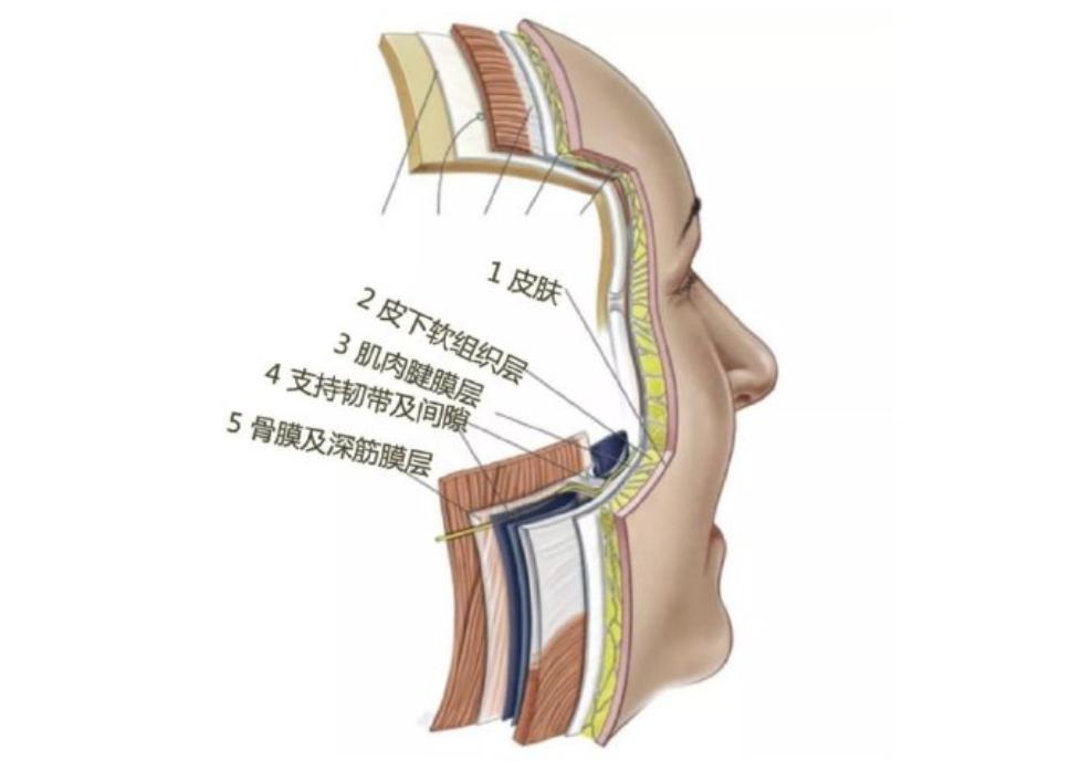 热玛吉法令纹消失了,热玛吉和fotona4d哪个法令纹效果好