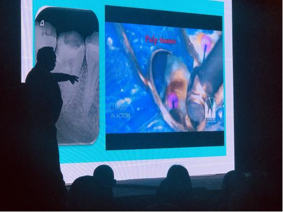 根管治疗难点与解决方案,根管治疗成功的关键是