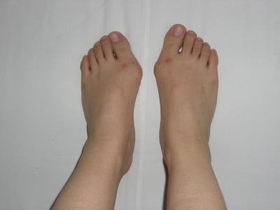 改善脚型的鞋垫真的有用吗,缓解足部疲劳鞋垫测评