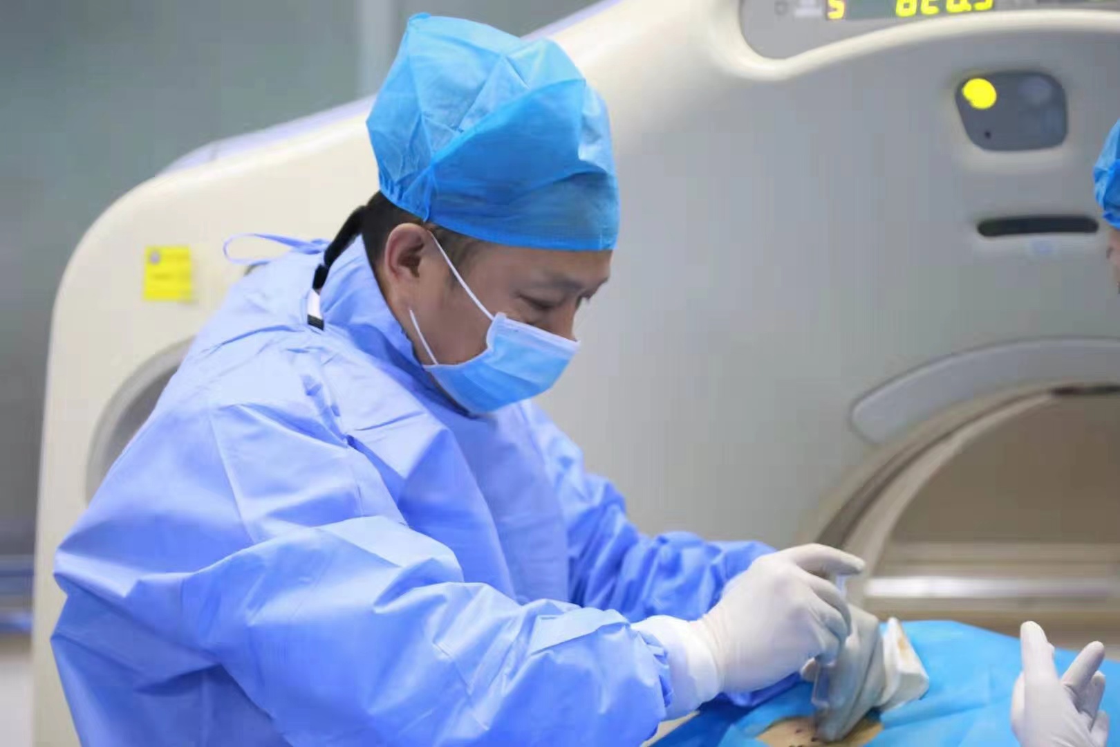 多处转移、无法手术的肺鳞癌患者被沈阳六院的一颗粒子治愈了