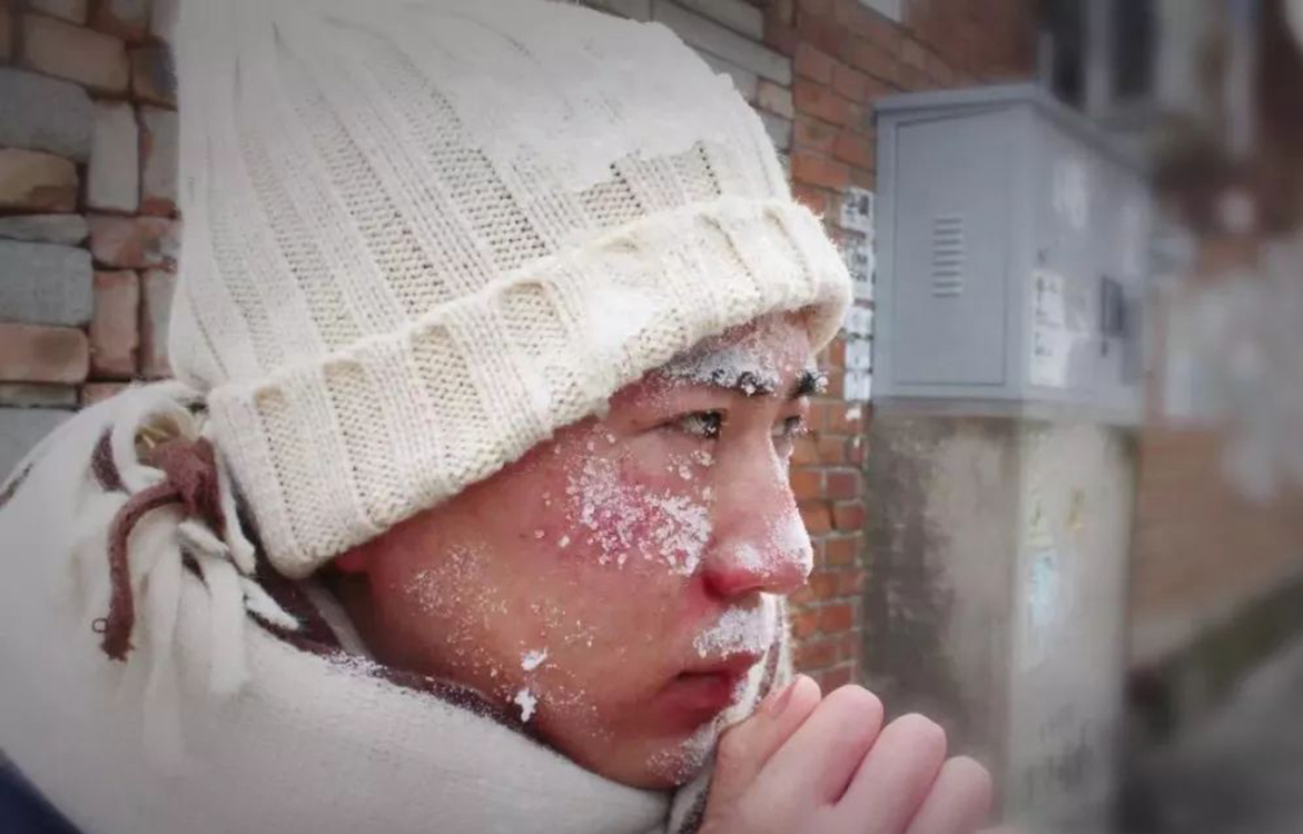 冬天脸上高原红,冬天脸上出现高原红怎么办