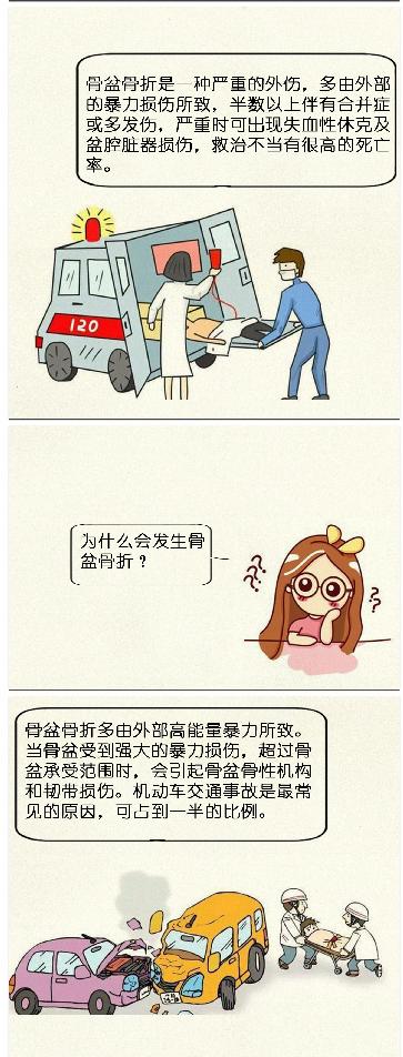 骨科髋部骨折科普视频,骨科大咖髋部骨折科普视频