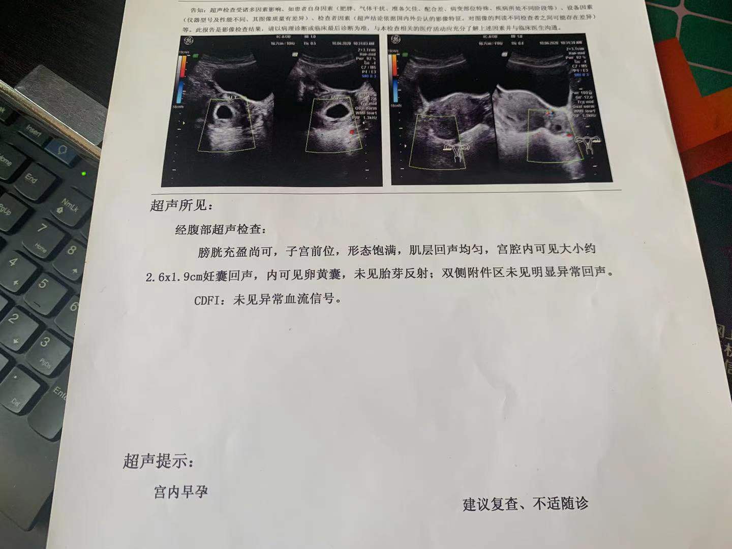 突然发现怀孕的惊喜,怀孕时的心路历程