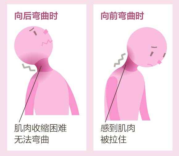 肌肉放松状态下很僵硬怎么放松,如何让僵硬紧绷的肌肉恢复正常