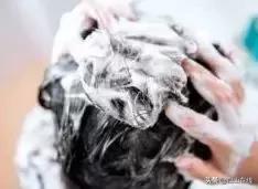 90后发际线秃了,90后怎么挽救发际线秃顶