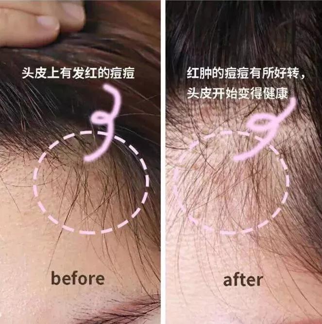 一款洗发水好用就要用到天荒地老,推荐几款洗发水要洗完很香的