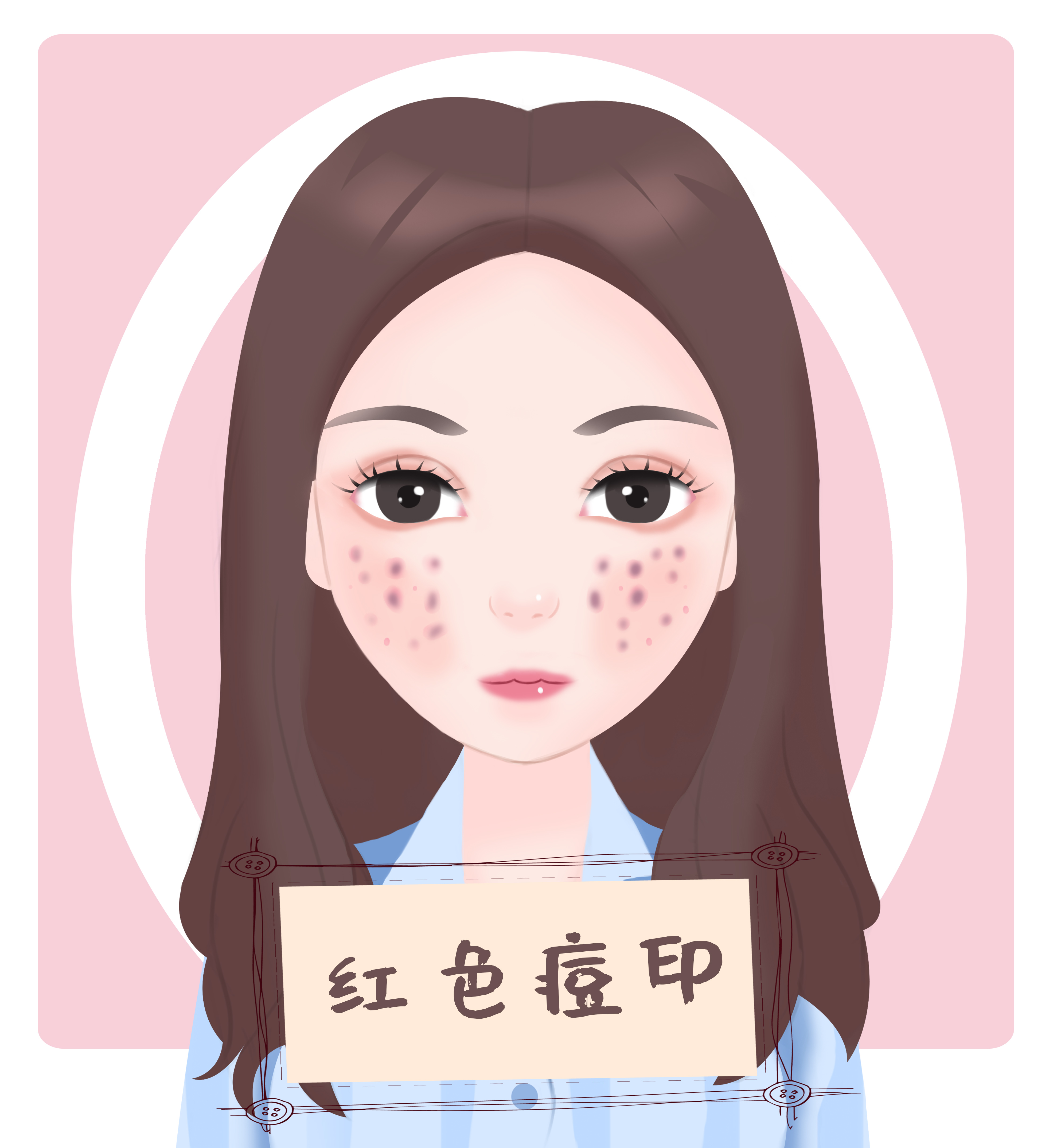 产后痘印怎么快速消除,如何快速消除痘印最有效方法