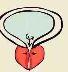 急性前列腺炎的最佳治疗方法,急慢性前列腺炎用什么药消炎