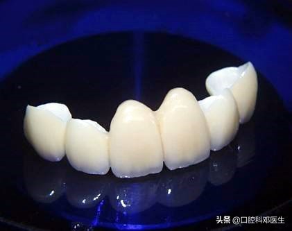 牙医为啥都推荐种植牙,为什么医生总是推荐做全瓷牙