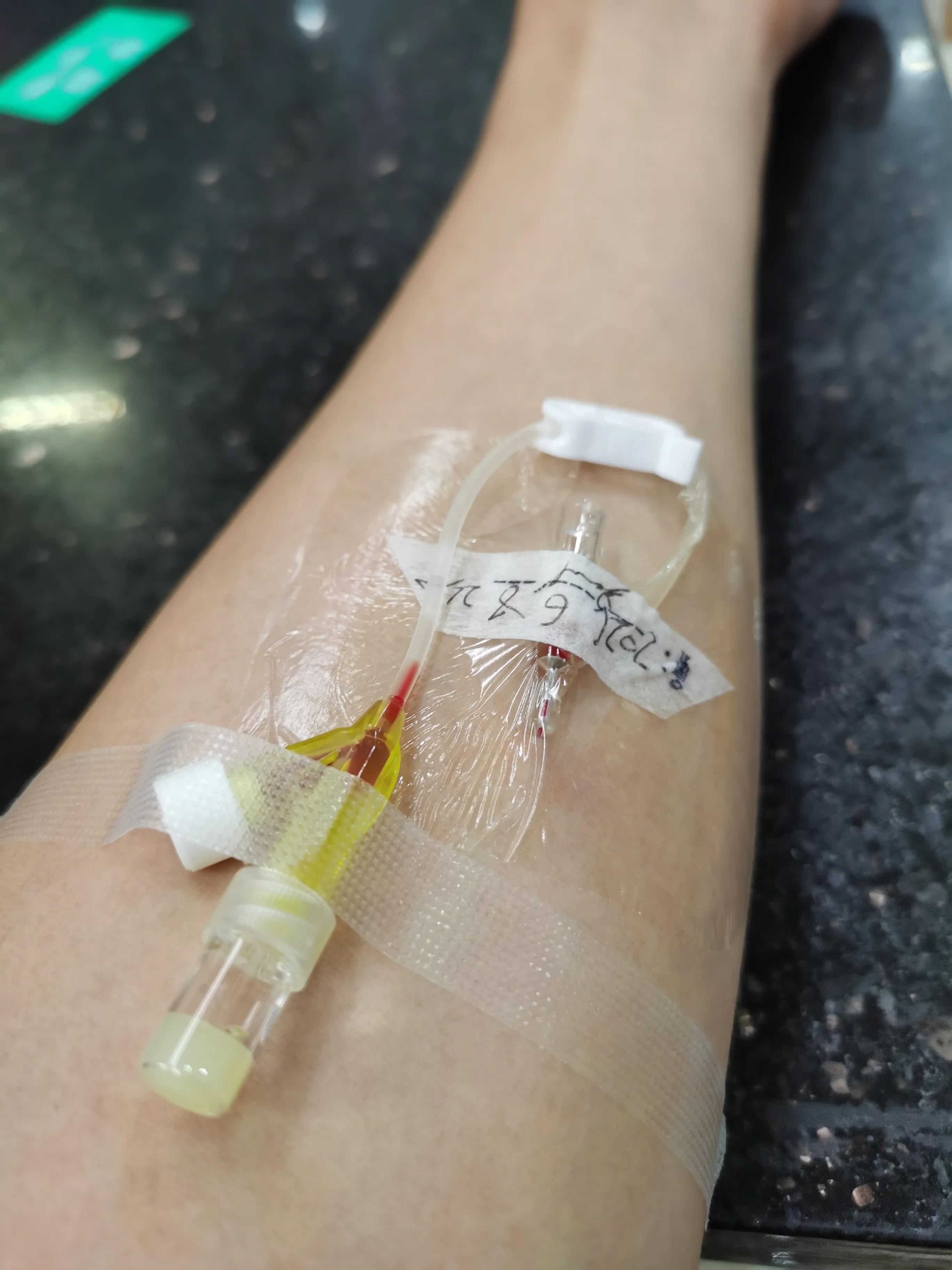 第五跖骨基底部骨折60天能走路吗,第五跖骨基底部骨折60天能脱拐吗