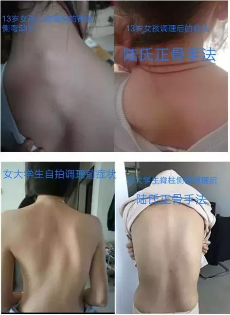 陆氏九龙正骨全套完整视频,陆氏正骨