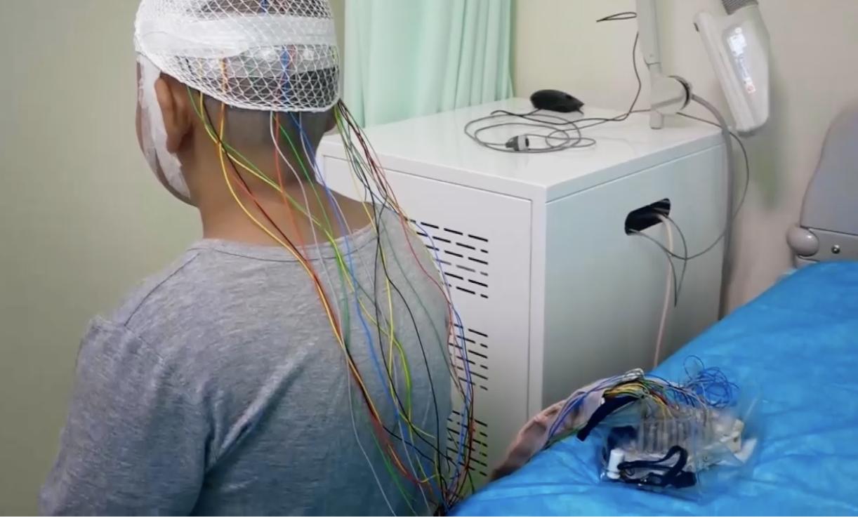 鞍结节脑膜瘤误诊为垂体瘤,鞍结节脑膜瘤发病原因