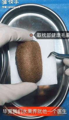 我在快手上看人切洋葱，竟然弄懂了剖腹产？
