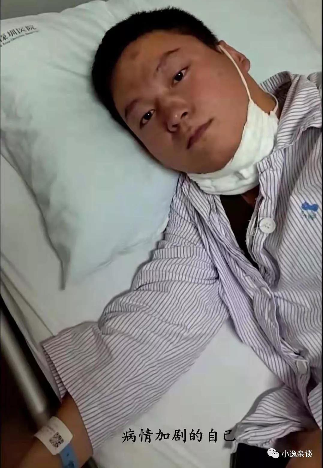 皮肌炎病史,皮肌炎二十年没有治疗