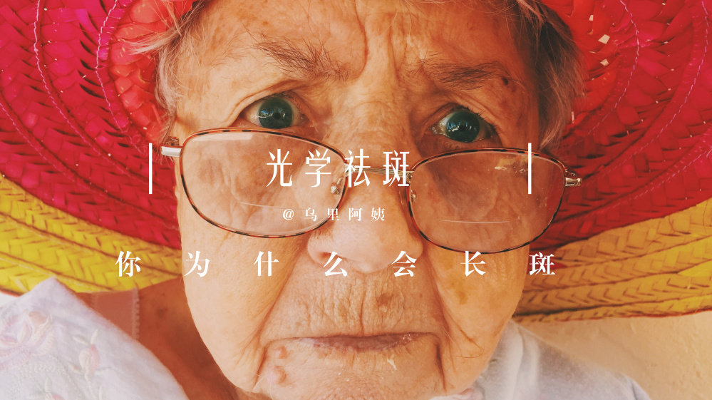 长斑了不用慌了解根源最重要,突然发现长斑了赶紧补救可以吗