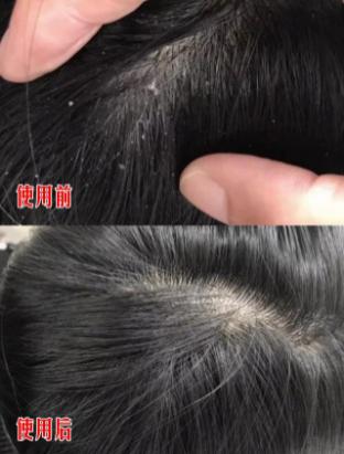 头发蓬松茶树油洗发水,油头救星澳洲茶树洗发水