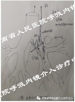 不小心吃进甲鱼骨头,不小心吃了甲鱼骨头