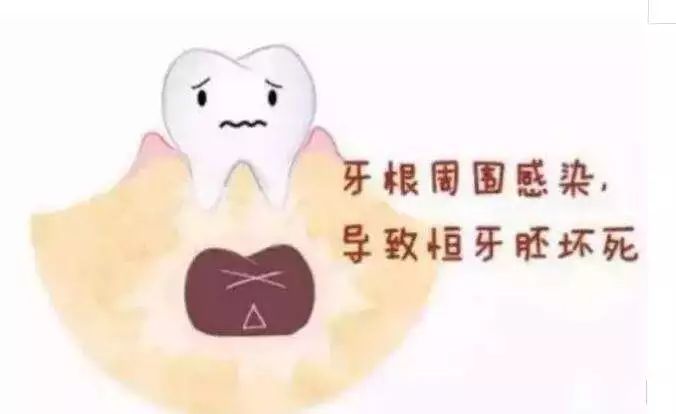 窝沟封闭预防龋齿会有什么危害吗,窝沟封闭后将有效预防孩子龋齿