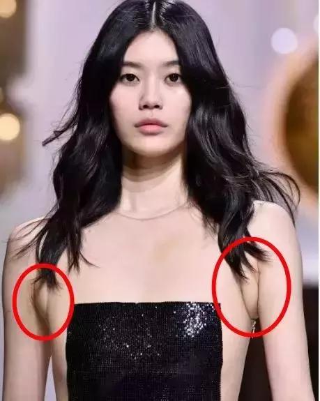 超模消除副乳,超模收副乳