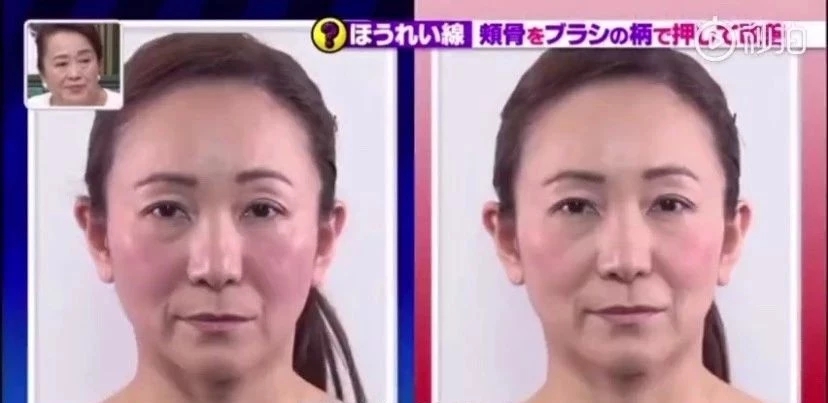 二十几岁法令纹特别明显是为什么,为什么比同龄人法令纹特别重