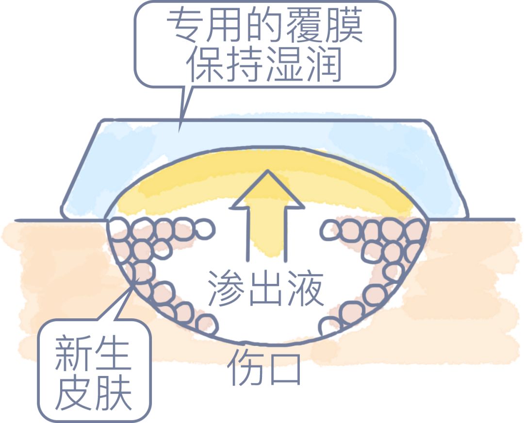 伤口结痂反而愈合慢你知道吗,伤口结痂反而愈合慢了