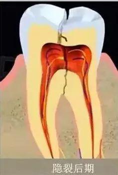 大连齿医生牙齿修复,大连齿医生口腔医院怎么样