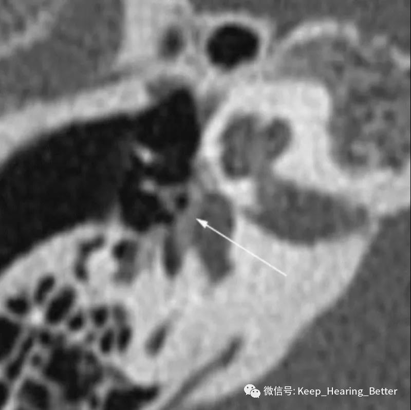 南大二附院,南大二附院耳鼻喉科专家