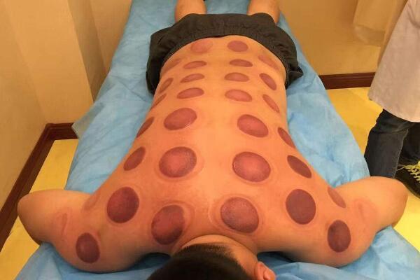 不吃药如何有效祛湿气,身体寒气湿气重如何按摩调理