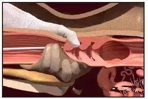 给母牛人工授精的步骤,给牛人工授精注意哪些