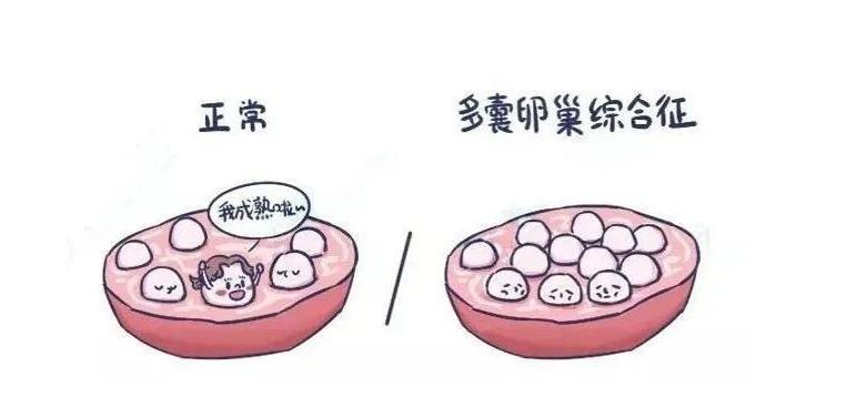 b超检查卵巢有低回声团块是什么,b超查出卵巢多囊就一定准确吗