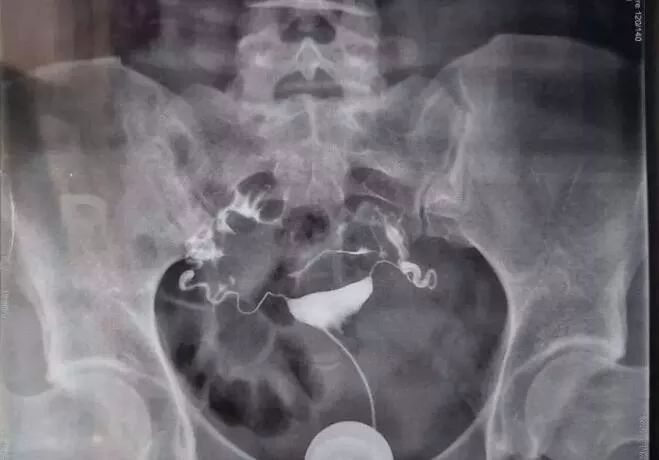 想要个宝宝怎么就那么难呢,想要一个宝宝为什么这么难