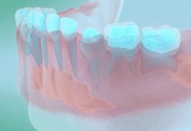 恒牙出来多久了乳牙未掉需要拔牙,孩子乳牙未掉用干预吗