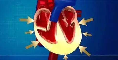 心律不齐需不需要过度治疗,心律不齐是否可以治愈