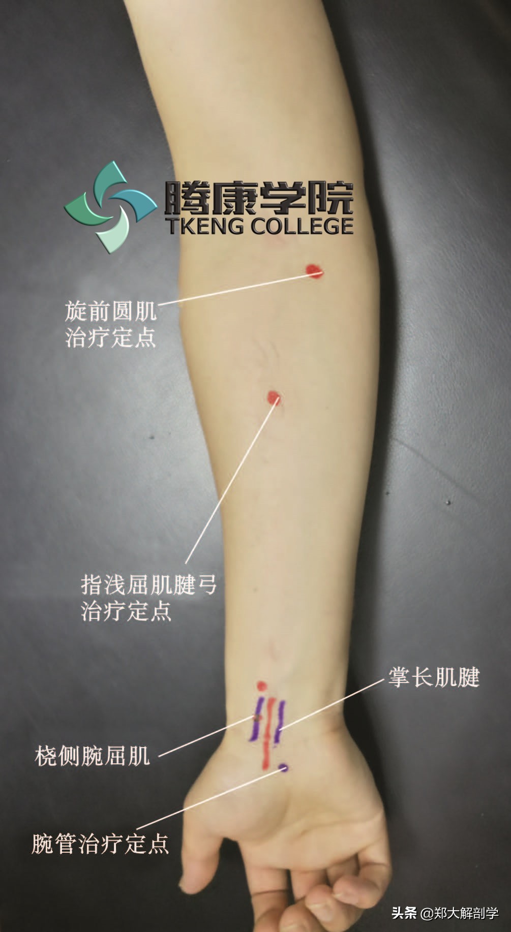 臂丛三束的主要分支,臂丛锁骨下部的主要分支及分布
