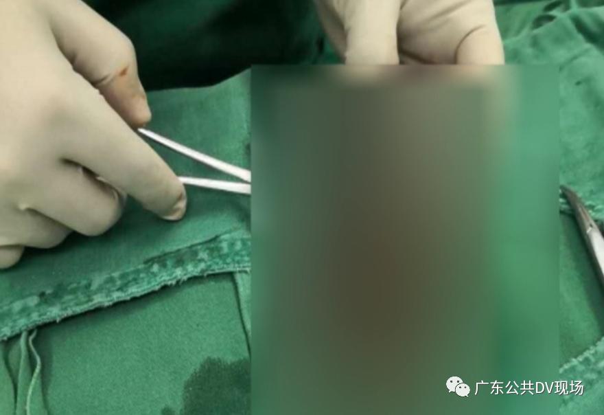 “蛋蛋”的忧伤！男孩突然“蛋疼”不止，隔天送医被切除，医生提醒