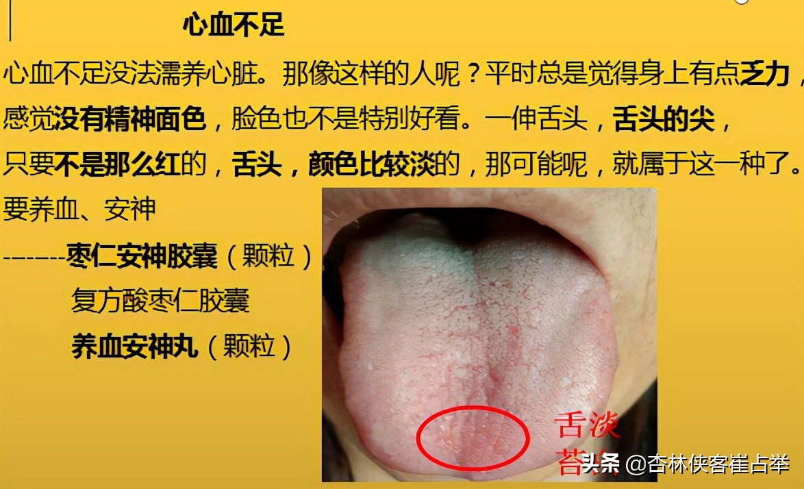 治疗失眠什么中成药效果好,治疗失眠中成药大总结