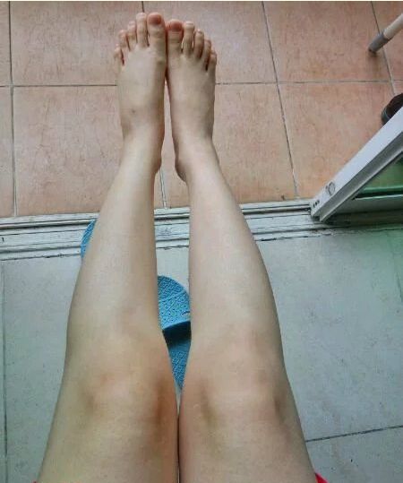 “鸡皮”仙女看过来！教你几招轻松去“鸡皮”