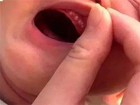 新手妈妈的20个不知道,让宝宝远离生病的40个误区