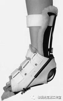 伊里扎洛夫外固定架治疗足部畸形,足部畸形矫正的技巧