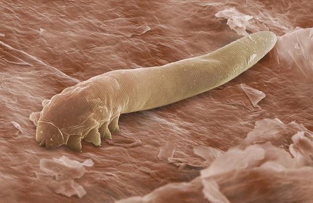 鼻子上挤出来的黄东西是什么,鼻子上挤出的黄色物体