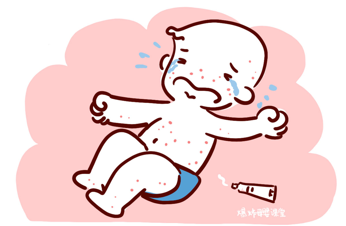 宝宝夏天长痱子用什么药膏,宝宝夏天长痱子用什么药最好