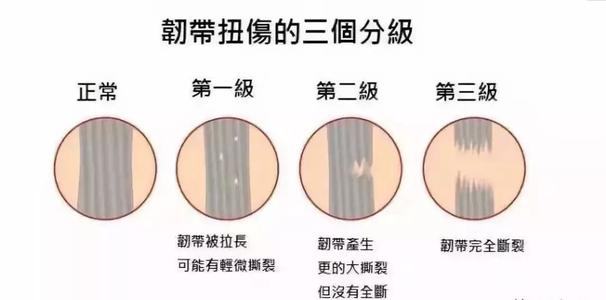 经常崴脚预示着什么心理问题,经常崴脚了伤到筋的表现