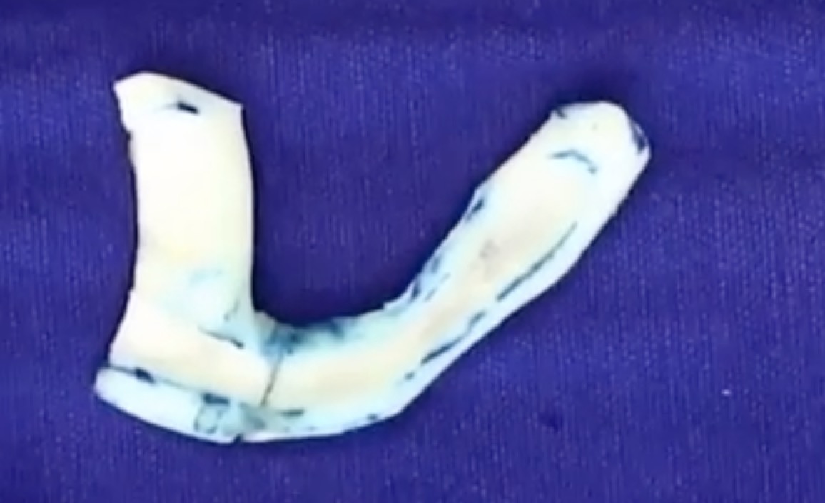 五官改善的最佳方法,五官整形修复