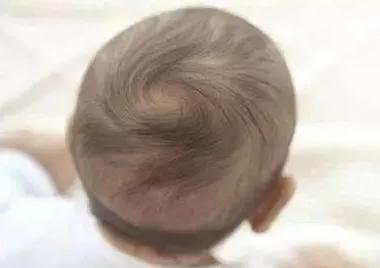 宝宝会脱发是怎么回事,如何判断宝宝脱发是正常还是缺钙