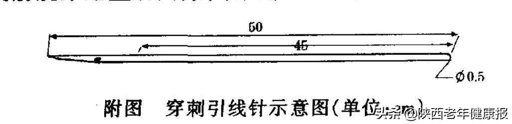 「硬核技术」男友为25岁“石女”寻医