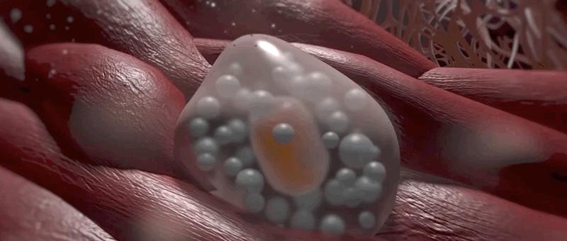 哮喘过敏症的症状,呼吸道过敏哮喘症状