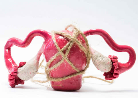 什么因素导致宫颈糜烂,哪些因素导致宫颈糜烂